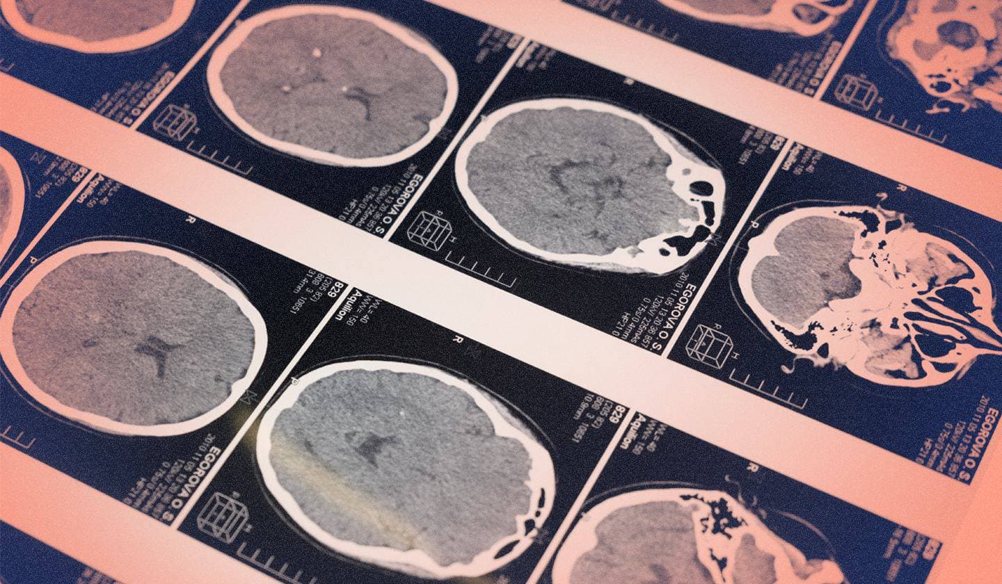 LLM으로 Elastic 탐지 기술 가속화